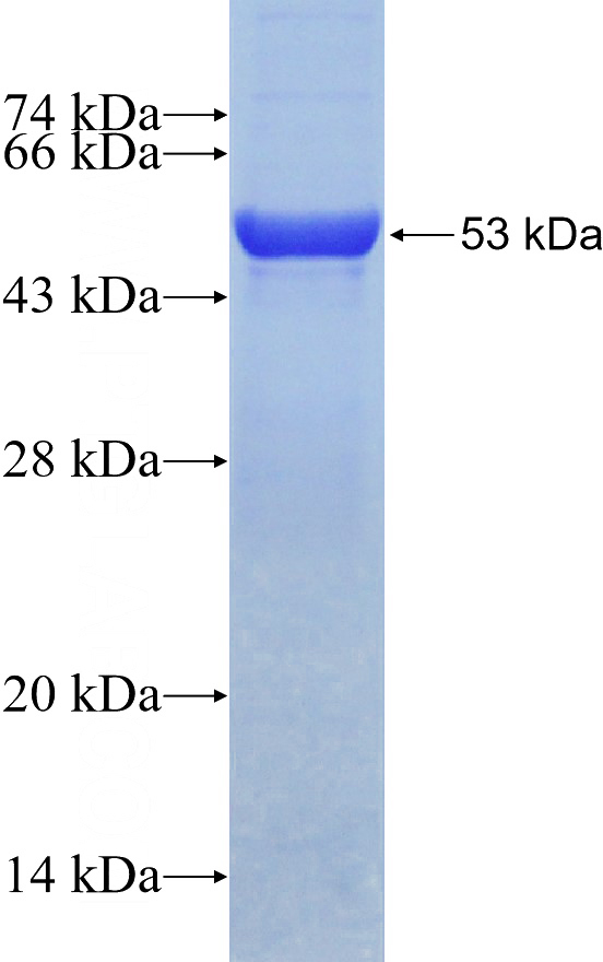Recombinant Human GDI2 SDS-PAGE