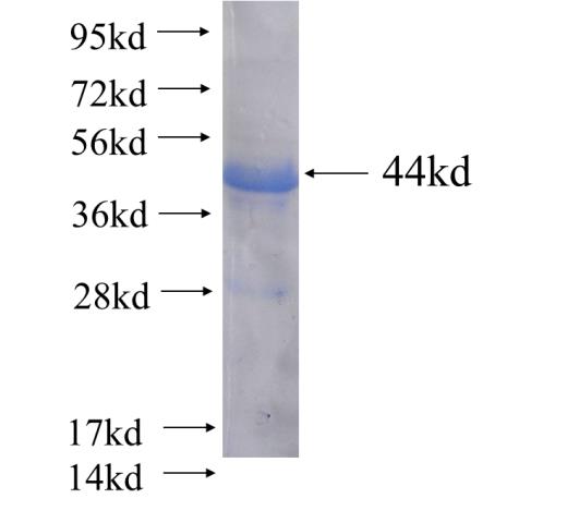 Recombinant human SORL1 SDS-PAGE