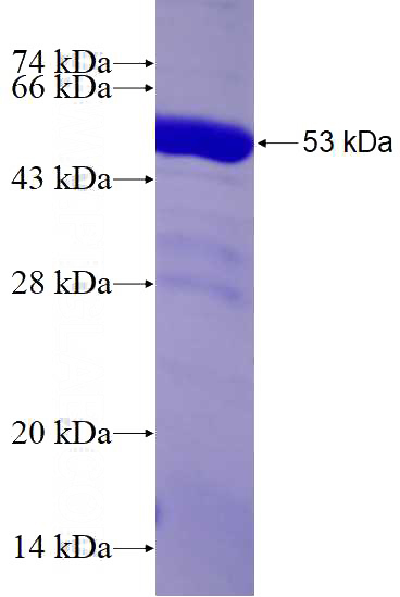 Recombinant Human RGS3 SDS-PAGE