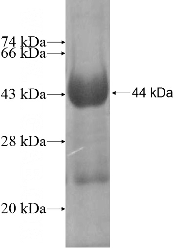 Recombinant Human HEXDC SDS-PAGE