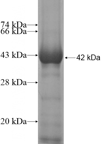 Recombinant Human Kindlin 3 SDS-PAGE