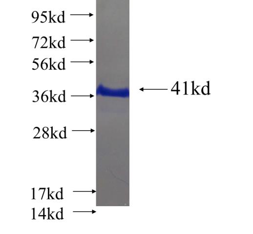 Recombinant human SLC25A1 SDS-PAGE
