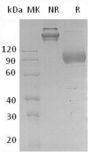 Human IL17RA/IL17R (Fc tag) recombinant protein