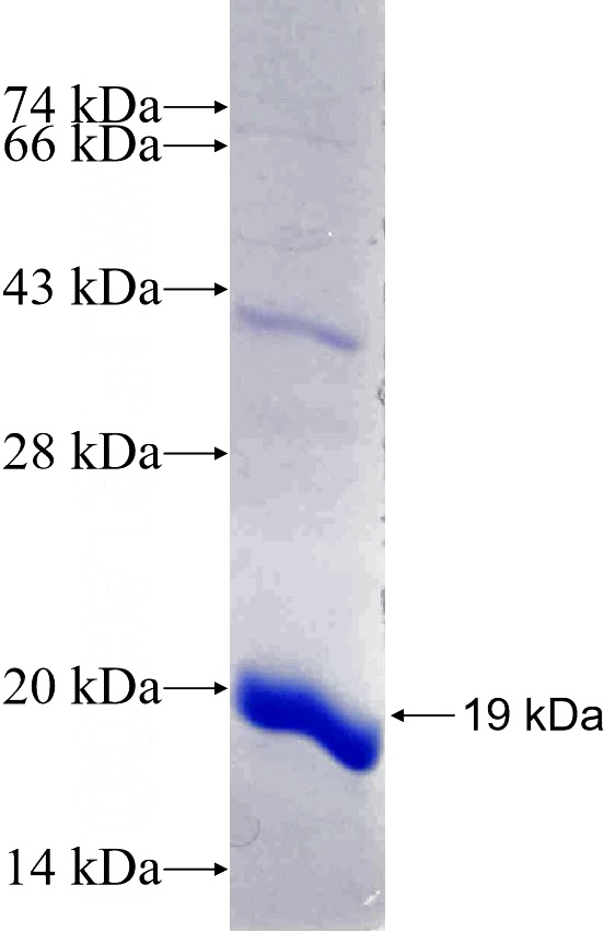Recombinant Human RPS15A SDS-PAGE