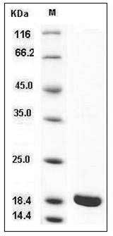 Rat IL-1 beta / IL1B Protein (mature form) SDS-PAGE