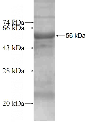 Recombinant Human PSMB8 SDS-PAGE