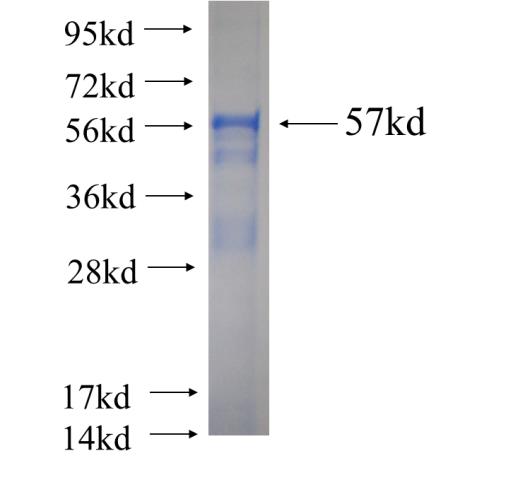 Recombinant human DCI SDS-PAGE