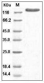 Human Contactin 3 / CNTN3 Protein (708 Asp/Asn, His Tag) SDS-PAGE