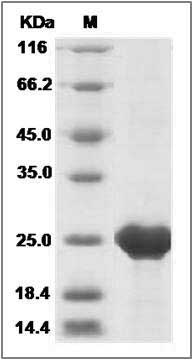 Mouse CNTF / Ciliary Neurotrophic Factor Protein (His Tag) SDS-PAGE