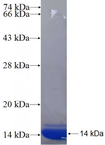 Recombinant Human ENAH SDS-PAGE