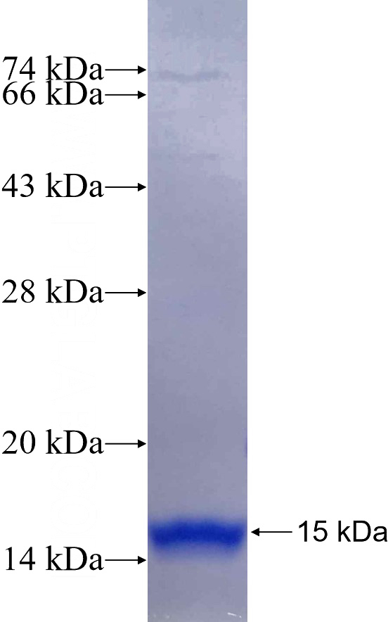 Recombinant Human CD1C SDS-PAGE