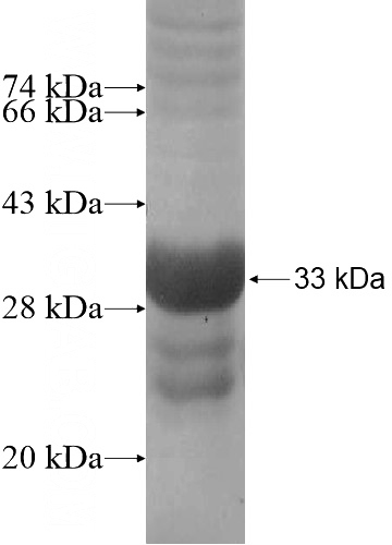 Recombinant Human ZNF493 SDS-PAGE
