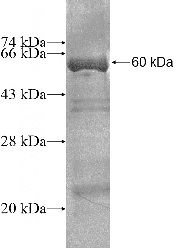 Recombinant Human TTC19 SDS-PAGE