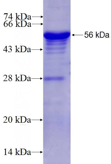 Recombinant Human MEIS2 SDS-PAGE