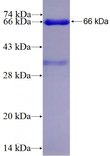 Recombinant Human RARB SDS-PAGE