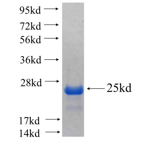 Recombinant human FA2H SDS-PAGE