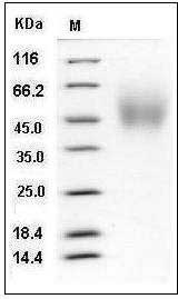 Human TrkA / NTRK1 Protein (aa 194-413, His Tag) SDS-PAGE