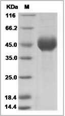 Influenza A H7N1 (A/turkey/Italy/4602/99) Hemagglutinin / HA1 Protein (His Tag)