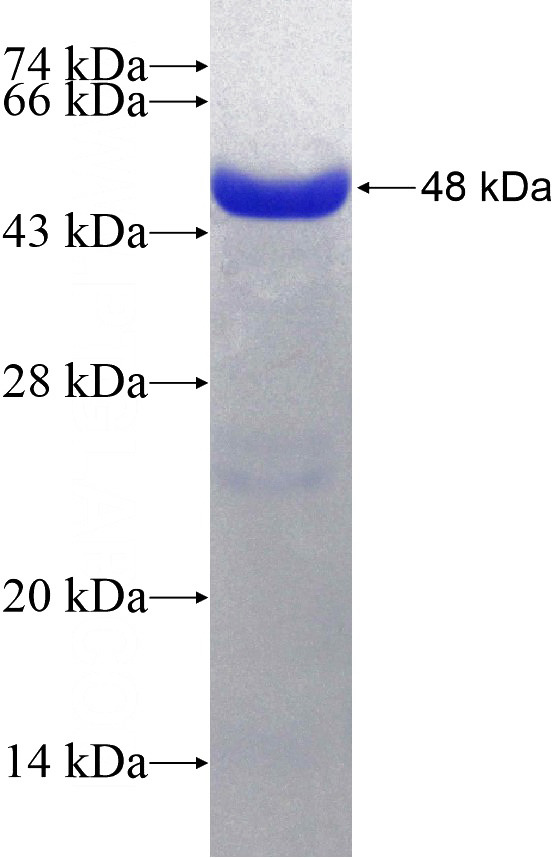 Recombinant Human CALD1 SDS-PAGE