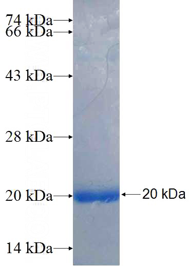 Recombinant Human DOCK4 SDS-PAGE