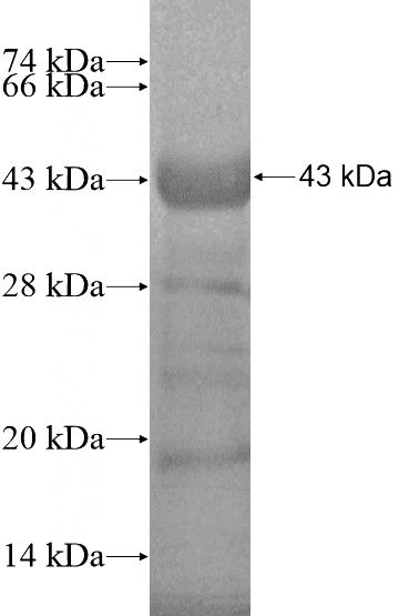 Recombinant Human SMC4 SDS-PAGE