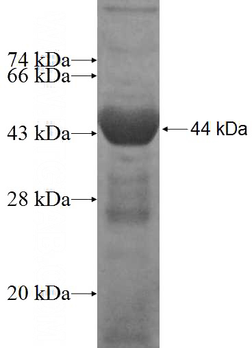 Recombinant Human MAN2C1 SDS-PAGE