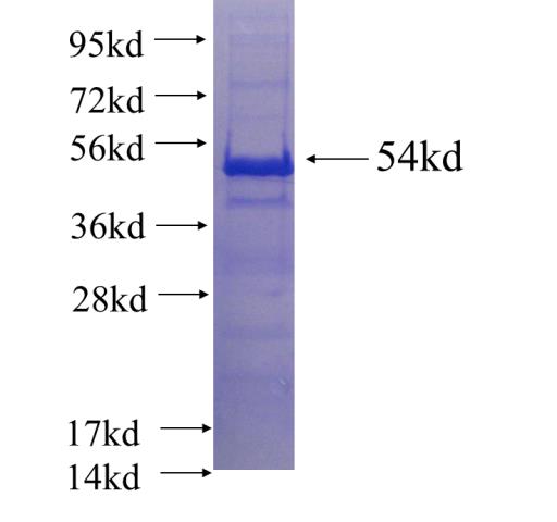Recombinant human DNAJB14 SDS-PAGE