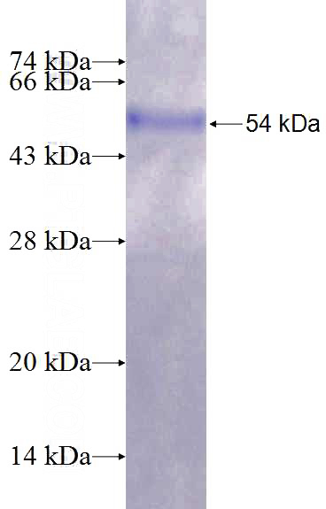 Recombinant Human RGS18 SDS-PAGE