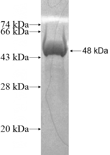 Recombinant Human LRRC43 SDS-PAGE