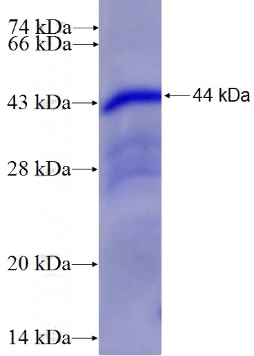 Recombinant Human PFKP SDS-PAGE