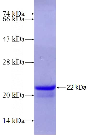 Recombinant Human SAP18 SDS-PAGE