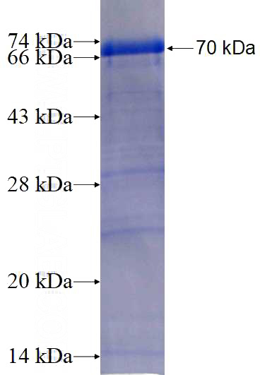 Recombinant Human LTBP1 SDS-PAGE
