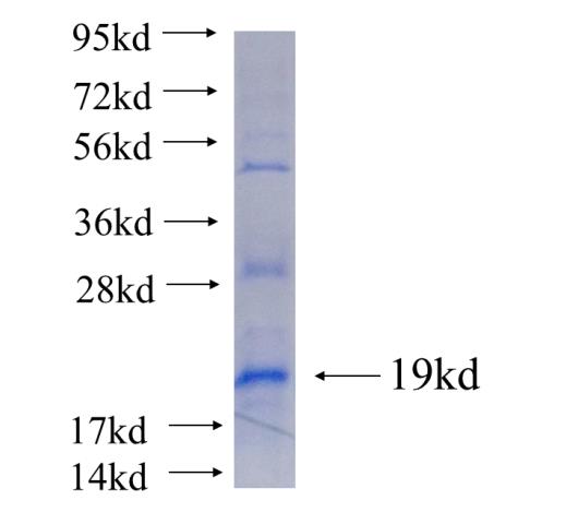 Recombinant human TUSC5 SDS-PAGE