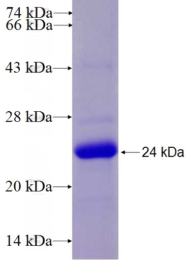 Recombinant Human FSTL3 SDS-PAGE