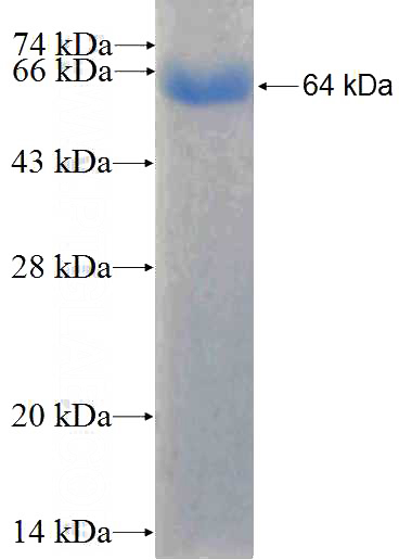 Recombinant Human CLTC SDS-PAGE