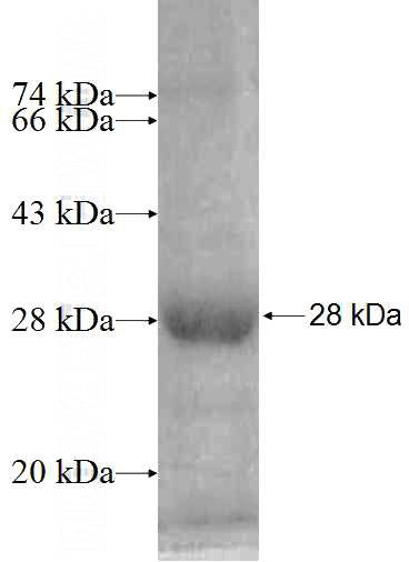 Recombinant Human FAM108A1 SDS-PAGE