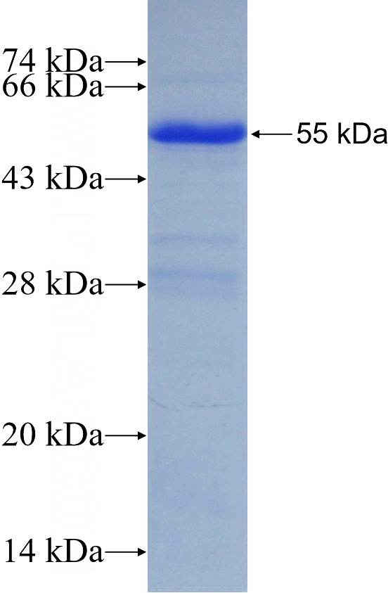Recombinant Human U2AF35 SDS-PAGE