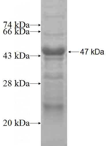 Recombinant Human LPHN1 SDS-PAGE