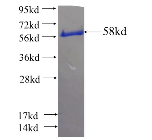 Recombinant human SAAL1 SDS-PAGE