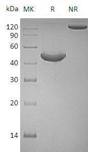 Human TNFRSF18/AITR/GITR/UNQ319/PRO364 (Fc tag) recombinant protein