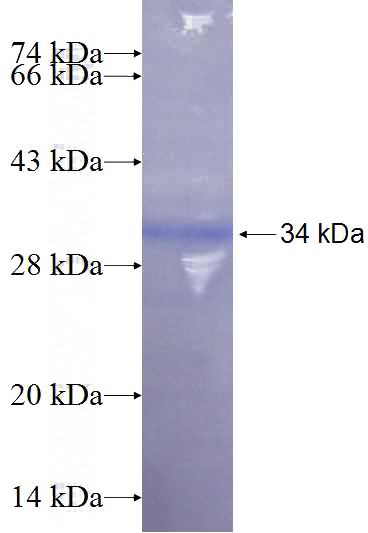 Recombinant Human PAM16 SDS-PAGE