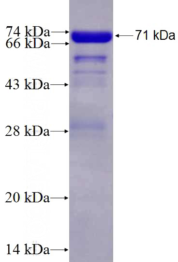Recombinant Human RBM17 SDS-PAGE