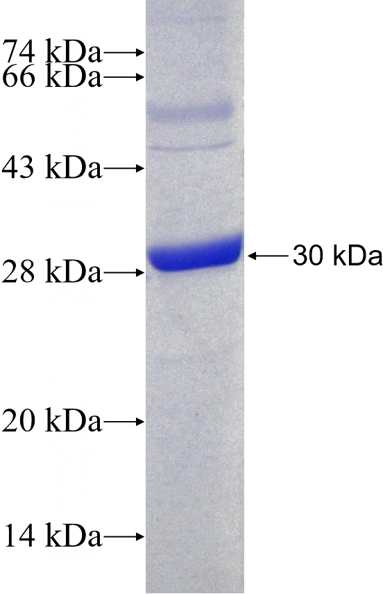 Recombinant Human SFMBT1 SDS-PAGE