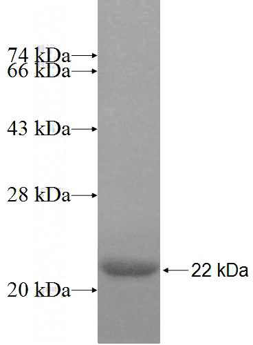 Recombinant Human NFKBID SDS-PAGE