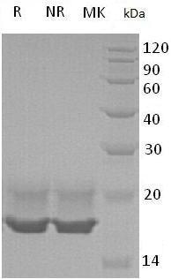 Human CDNF/ARMETL1 (His tag) recombinant protein
