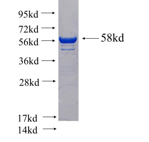 Recombinant human SH3GL2 SDS-PAGE