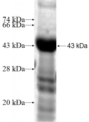 Recombinant Human NPHP4 SDS-PAGE