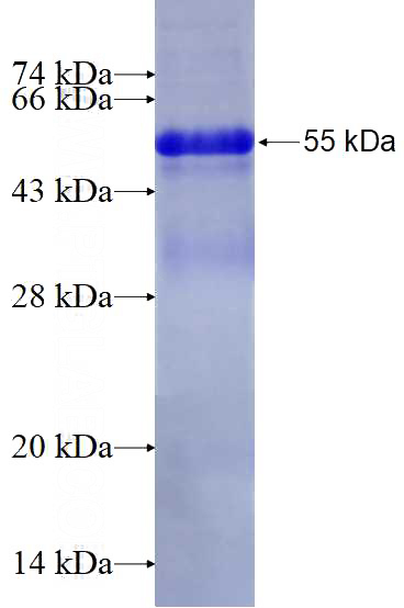 Recombinant Human C5, C5a SDS-PAGE