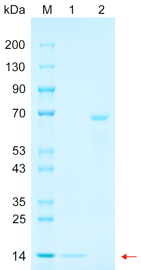 Recombinant ZNT8 protein (His tag) SDS-PAGE
