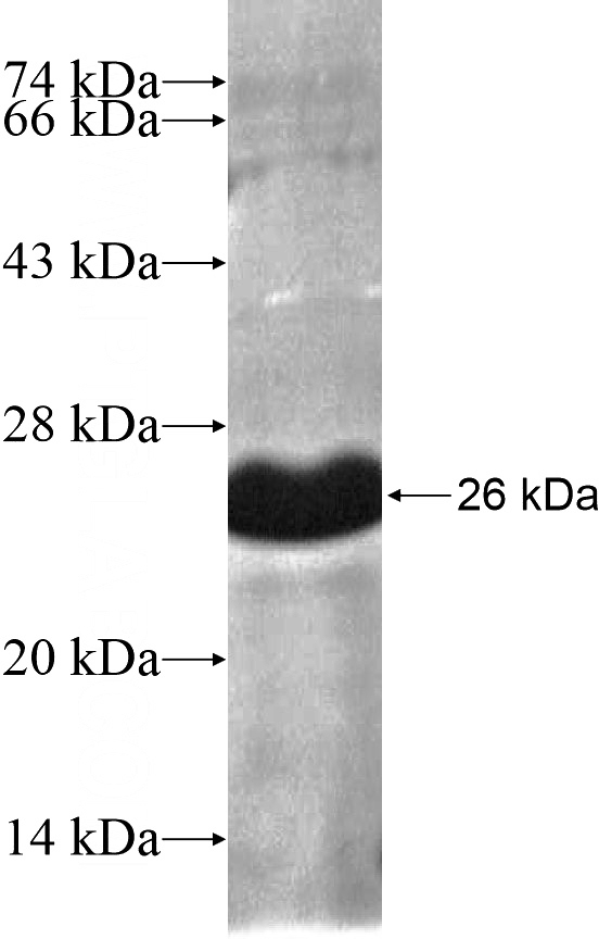 Recombinant Human RHBDL3 SDS-PAGE